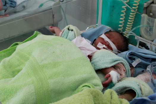 Cứu sống bé sơ sinh thiếu tháng nặng 1,5kg bị bỏ rơi-1