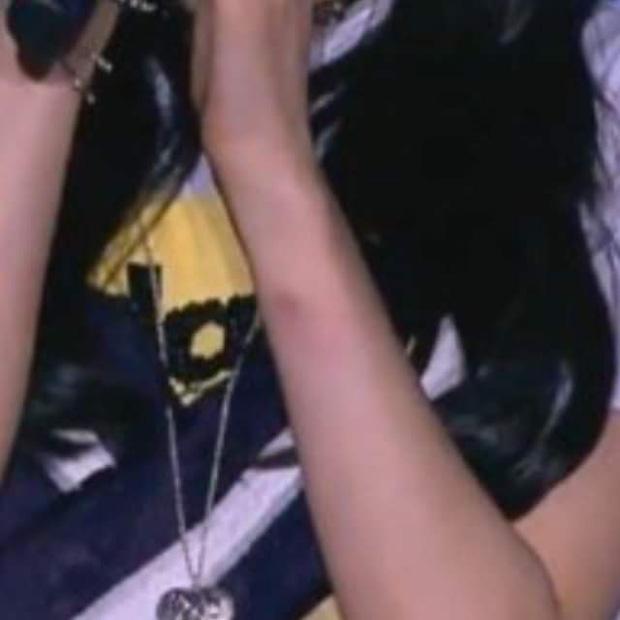 Taeyeon biểu diễn với cánh tay bầm tím sau sự cố bị sàm sỡ ở sân bay-2