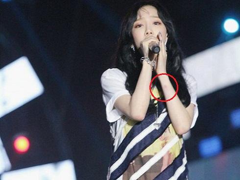 Thành viên nhóm nhạc U-Kiss bỏng độ 2 khi đang quay MV-2