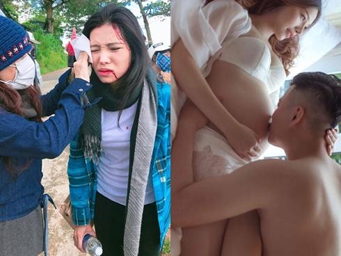 Vừa vạch mặt kẻ tố người tình trăng hoa, Lee Balan đã lại cười dù gương mặt bầm dập máu me