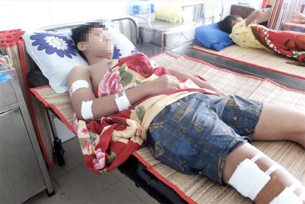 Đang đứng trước nhà, một học sinh lớp 10 bị chém nhập viện-1