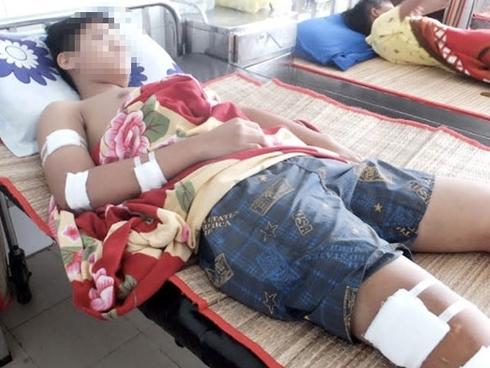 Đang đứng trước nhà, một học sinh lớp 10 bị chém nhập viện