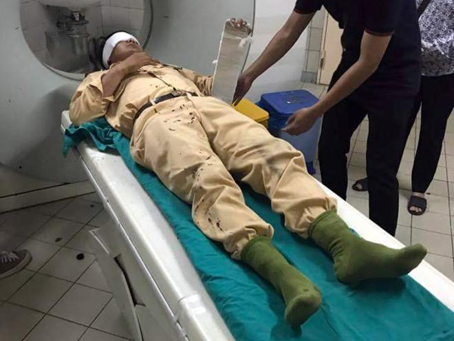 Trung úy CSGT nhập viện sau cú tông xe ở cầu Thanh Trì-1