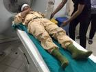 Trung úy CSGT nhập viện sau cú tông xe ở cầu Thanh Trì