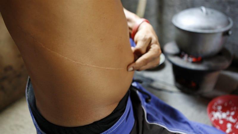 Thâm nhập đường dây buôn nội tạng (Kỳ 2): Lật tẩy chiêu trò đáng sợ của kẻ môi giới tìm người bán thận-1