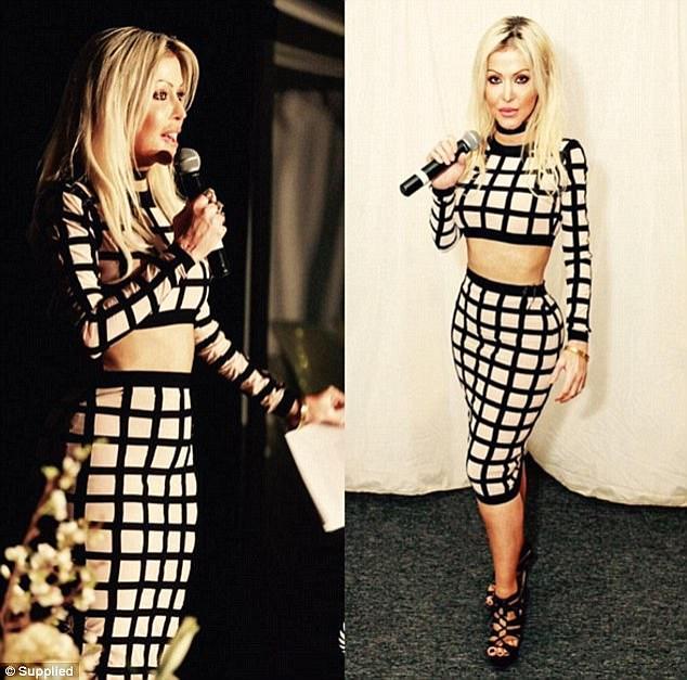 Ký ức kinh hoàng của cô gái bị người lạ thiêu sống như ngọn đuốc vì đánh ghen nhầm-1