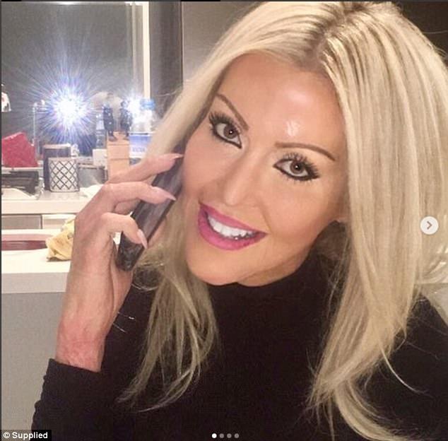 Ký ức kinh hoàng của cô gái bị người lạ thiêu sống như ngọn đuốc vì đánh ghen nhầm-6