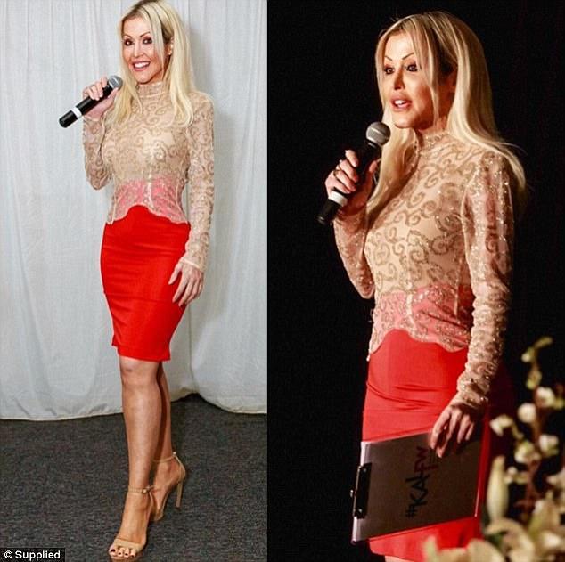 Ký ức kinh hoàng của cô gái bị người lạ thiêu sống như ngọn đuốc vì đánh ghen nhầm-9