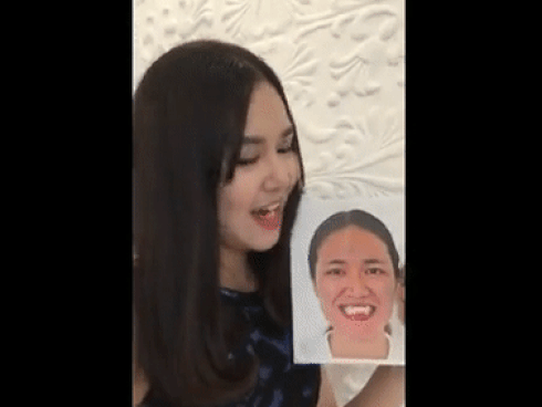 Nữ sinh từng bị gọi là dị nhân và khi lột xác nhờ thẩm mỹ: Chỉ ước sống như người bình thường!-10