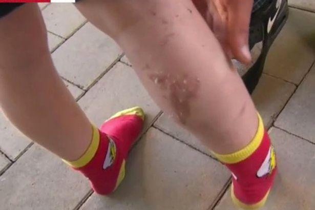 Đổ nước sôi vào chân bé trai 5 tuổi, tiếp viên hàng không thờ ơ gây phẫn nộ-2