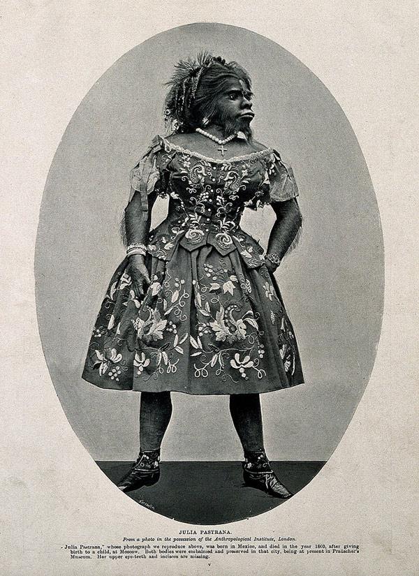 Bi kịch của người đàn bà xấu xí, chết còn bị chồng ướp xác trưng bày để… thu tiền-6