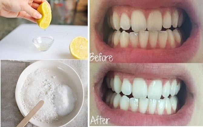 Thực tế làm trắng răng chỉ với 3 phút tại nhà bằng chanh muối hiệu quả đến đâu?-1