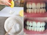 Thực tế làm trắng răng chỉ với 3 phút tại nhà bằng chanh muối hiệu quả đến đâu?
