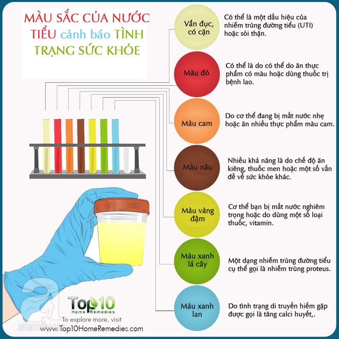 Màu sắc của nước tiểu cảnh báo tình trạng sức khỏe của bạn-1
