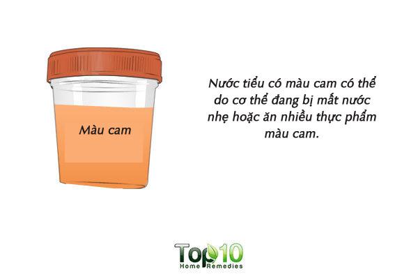 Màu sắc của nước tiểu cảnh báo tình trạng sức khỏe của bạn-4