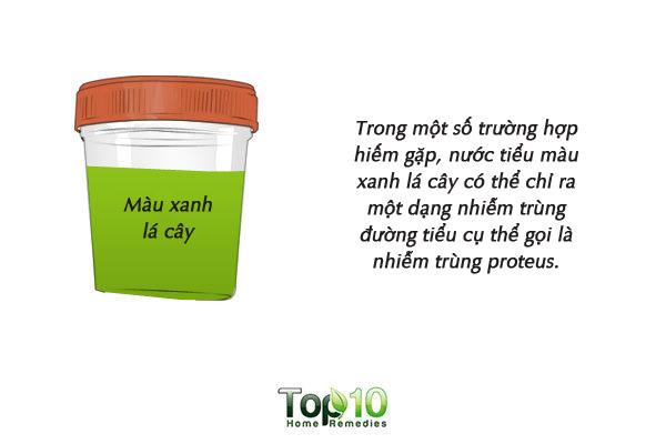 Màu sắc của nước tiểu cảnh báo tình trạng sức khỏe của bạn-7