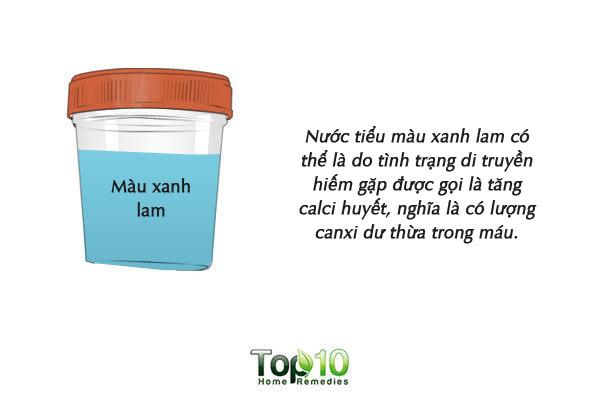 Màu sắc của nước tiểu cảnh báo tình trạng sức khỏe của bạn-8