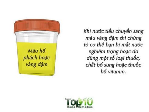 Vạch mặt thủ phạm khiến bạn luôn mệt mỏi dù ăn uống đủ chất, ngủ đủ giấc-3