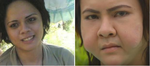 3 cô bạn thân người Philippines cùng biến dạng mặt vì tiêm filler giá rẻ-3