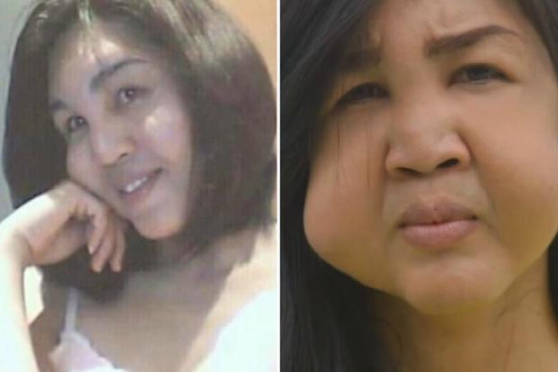 3 cô bạn thân người Philippines cùng biến dạng mặt vì tiêm filler giá rẻ-4