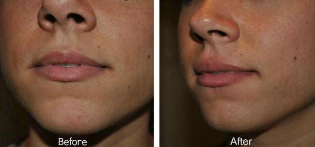 8 công thức bất bại làm đẹp da và tóc từ mật ong-10