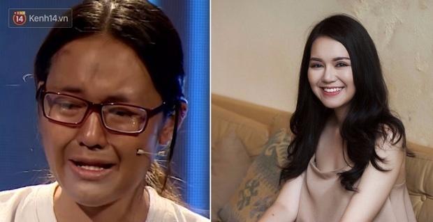 Nữ sinh từng bị gọi là dị nhân và khi lột xác nhờ thẩm mỹ: Chỉ ước sống như người bình thường!-1