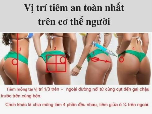 Tại sao tiêm thuốc ở mông là an toàn?