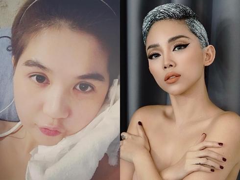 Tin sao Việt 28/8: Tóc Tiên bán nude quyến rũ - Ngọc Trinh sưng mặt vì nhổ răng