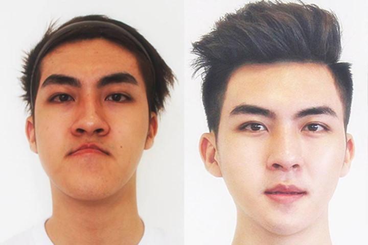 Sốc: Chàng trai Quảng Ninh mặt lưỡi liềm giờ đây đẹp như hotboy xứ Hàn-2