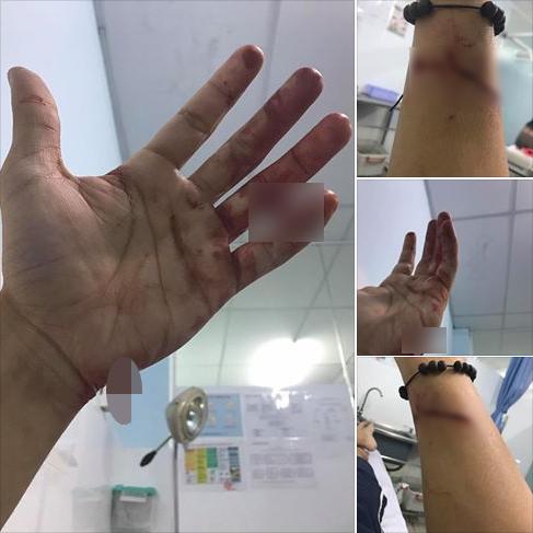 Ca sĩ Đông Hùng bị chém nát tay vì mẹ ruột vay lãi tiền tỷ-2