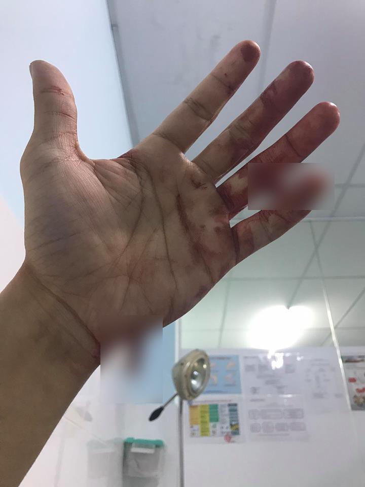 Ca sĩ Đông Hùng bị chém nát tay vì mẹ ruột vay lãi tiền tỷ-3