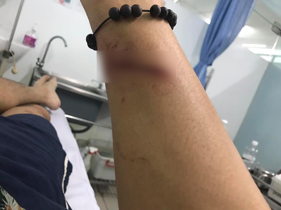 Ca sĩ Đông Hùng bị chém nát tay vì mẹ ruột vay lãi tiền tỷ-4
