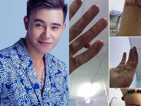 Chứng kiến Đông Hùng nát tay, Pha Lê lên tiếng: Đừng làm gì ảnh hưởng đến tính mạng, chị xin em-7