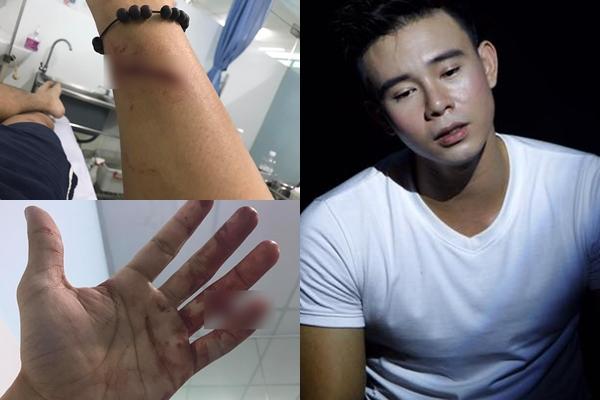 Sau vết chém vì mẹ ruột vay nặng lãi, Đông Hùng nhắn gửi: Mẹ à, đủ rồi đấy!-1