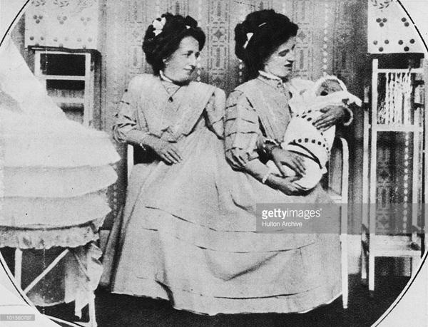 Chuyện ly kỳ về đời sống tình dục của cặp song sinh dính liền nổi tiếng lịch sử-3