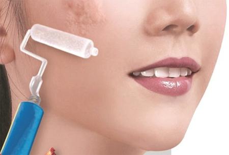 Hành tây giúp xóa các loại sẹo và làm đẹp da-1