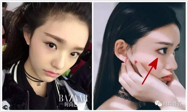 Dán mi dưới chệch, thủ thuật Angela Baby và nhiều sao Hoa ngữ áp dụng để có đôi mắt to tròn-7