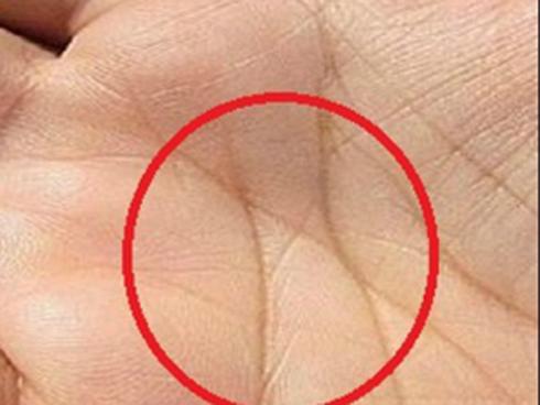 Bí ẩn đằng sau kí tự chữ X trong lòng bàn tay
