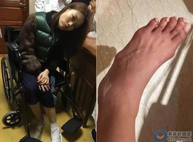 Siêu sao Hoa Ngữ biến dạng bàn chân vì sở thích đi giày cao gót quái chiêu-3