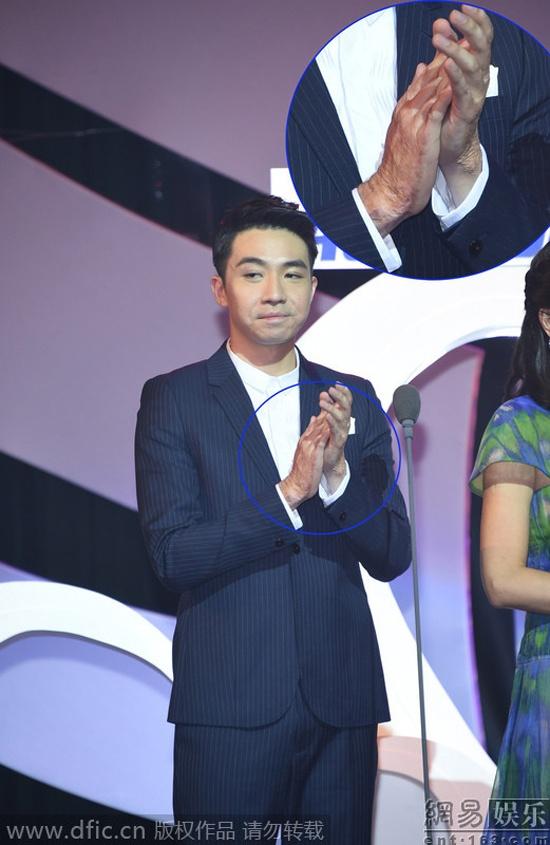 Sự trở lại ấn tượng của mỹ nam F4 bị bỏng nặng toàn thân sau vụ nổ kinh hoàng-5