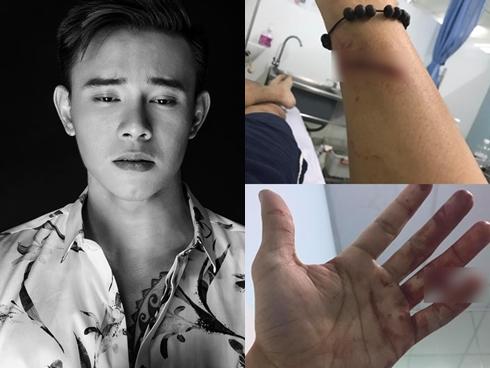 Tin sao Việt 5/9: Ngã bổ chửng giữa cổng đài truyền hình, Á hậu Tú Anh lo mình ế chồng vì tính hậu đậu-12