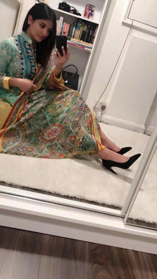 Hình ảnh mới sau khi tái tạo da của nữ sinh viên Anh bị tạt axit gây bất ngờ-4