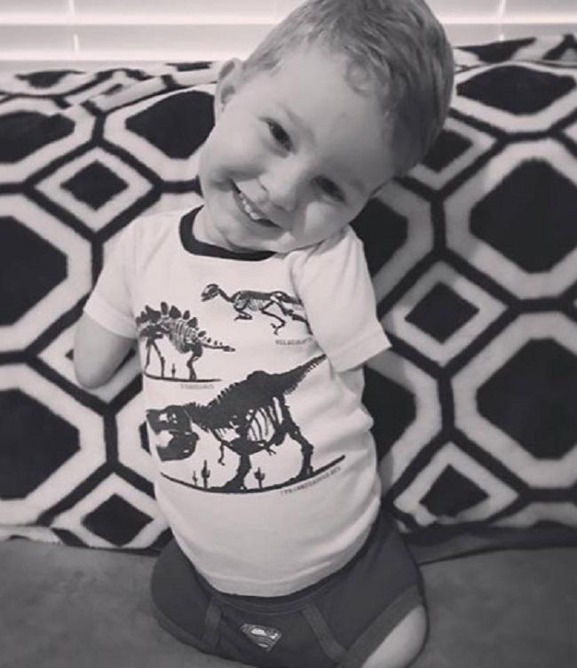 Hình ảnh cậu bé cụt tứ chi chơi cầu trượt khiến ai cũng rớt nước mắt-2