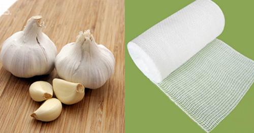 Trị mụn ruồi xấu xí với công thức đơn giản chưa đến 2 ngàn đồng-2