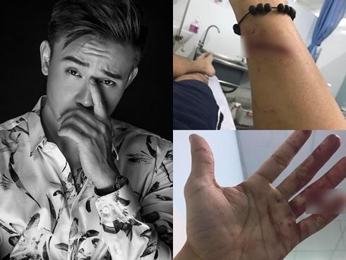 Đông Hùng: Lúc tôi thi Vietnam Idol, hơn phân nửa khán giả bên dưới đều là chủ nợ-11