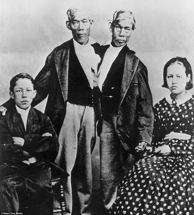 Cuộc sống trưng bày trong gánh xiếc của những người bị dị tật bẩm sinh ở thế kỷ 19-12