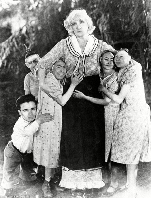 Cuộc sống trưng bày trong gánh xiếc của những người bị dị tật bẩm sinh ở thế kỷ 19-1