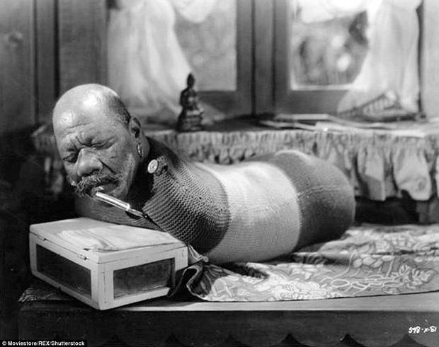 Cuộc sống trưng bày trong gánh xiếc của những người bị dị tật bẩm sinh ở thế kỷ 19-7