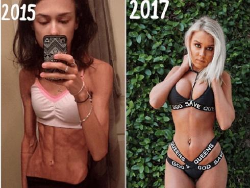 'Từ cõi chết trở về', cô gái như bộ xương khô 'lột xác' trở nên nóng bỏng khó tin