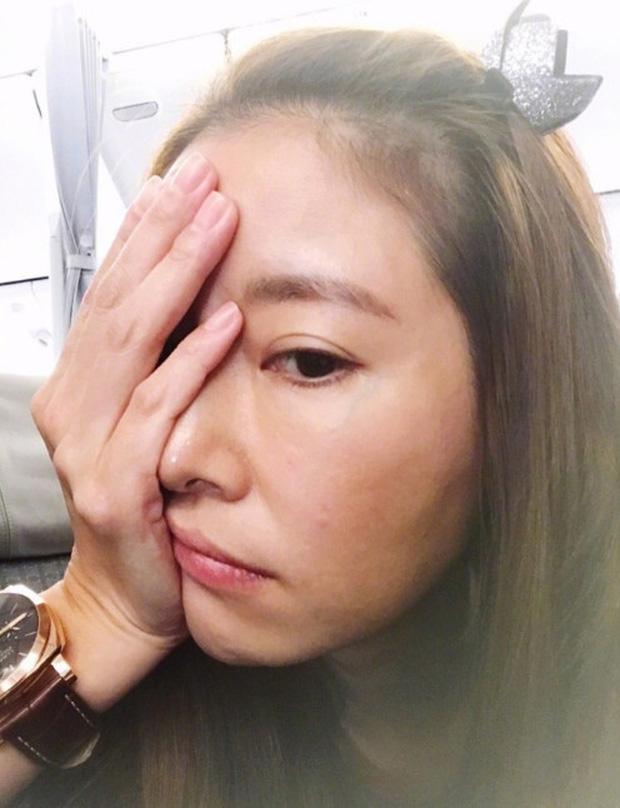 Hậu scandal lùm xùm với Nhĩ Khang, Lâm Tâm Như lộ gương mặt mỏi mệt với làn da kém mịn màng, nhiều nếp nhăn-2